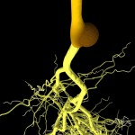 Bacterial gall Bacterial gall