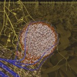 Root nodule Root nodule