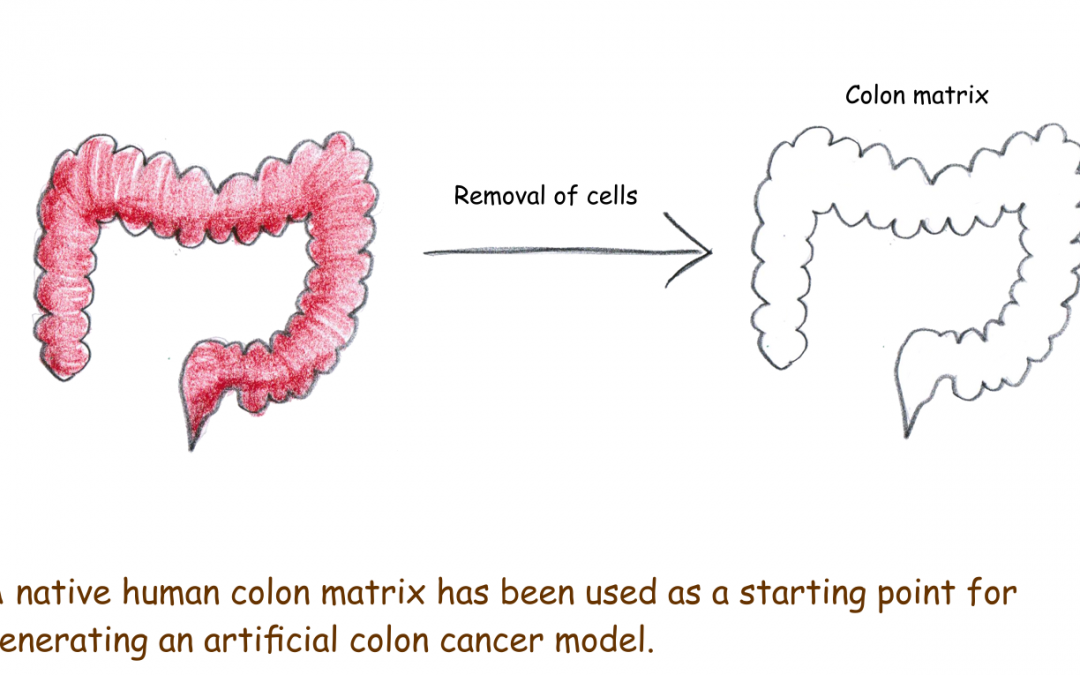 An artificial colon