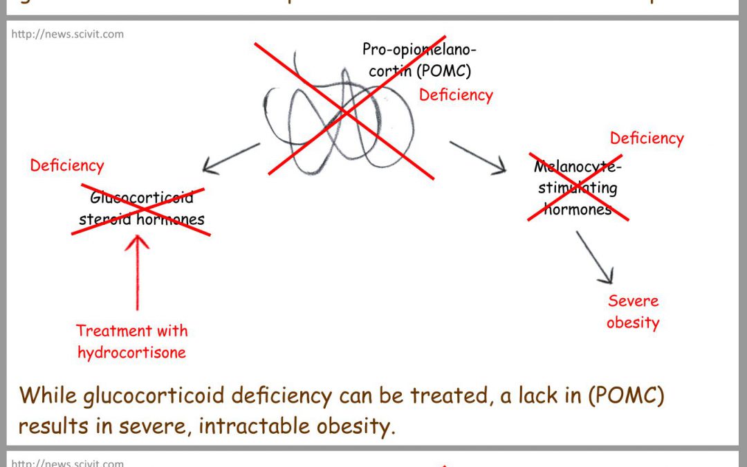 A rare form of hereditary obesity can now be cured