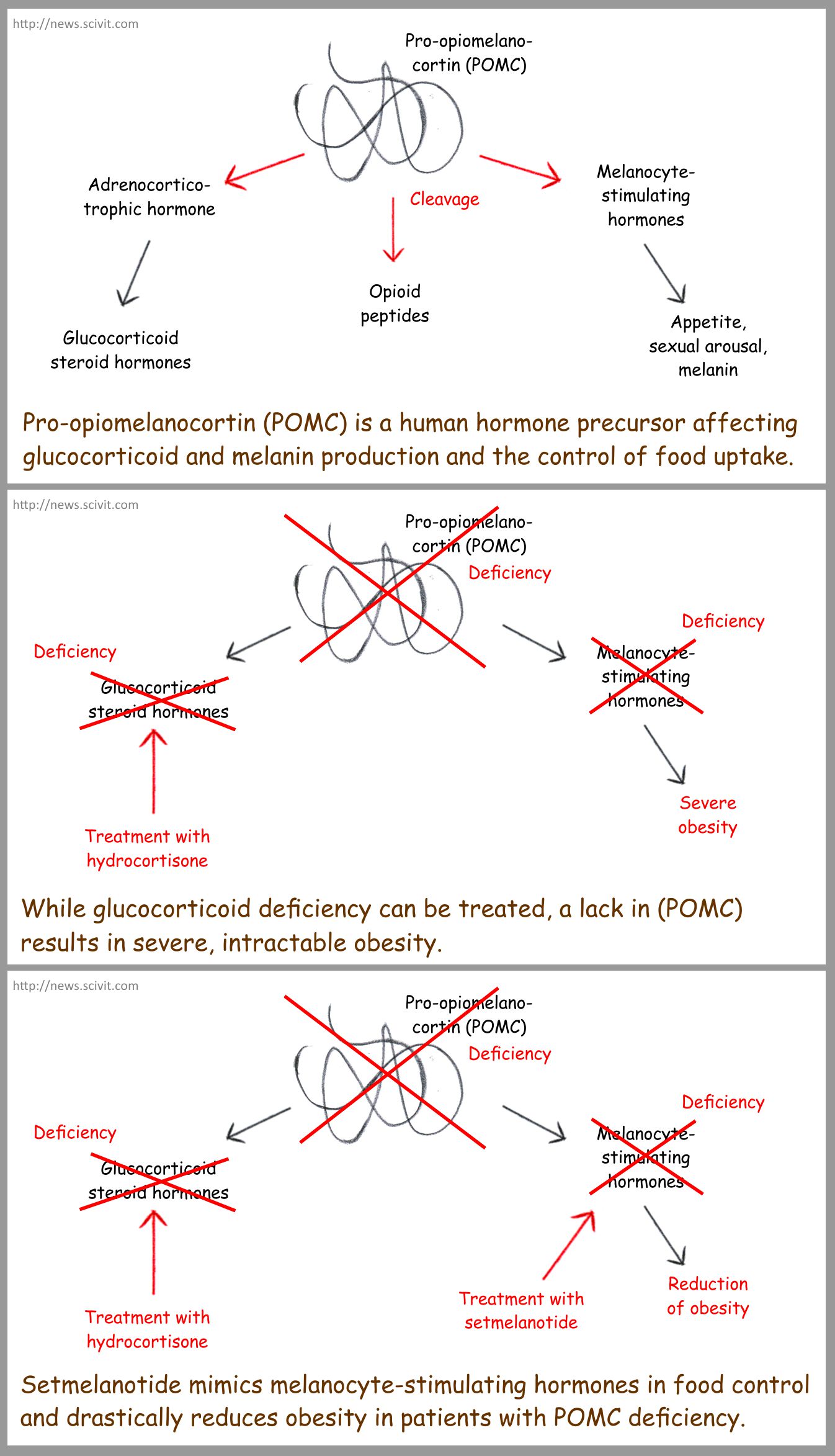 A rare form of hereditary obesity can now be cured - Scivit News