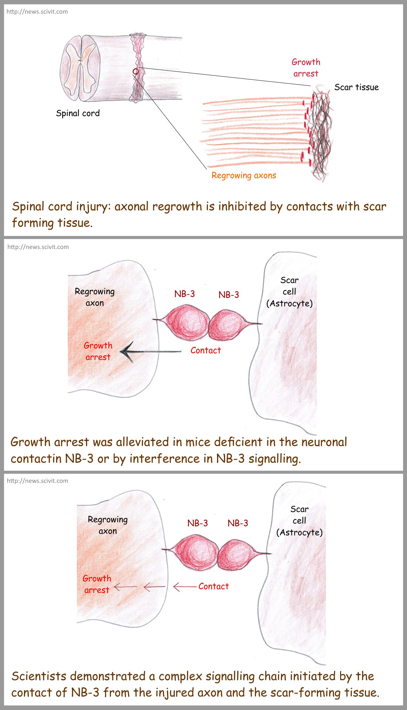 Spinal cord injuries - latest news