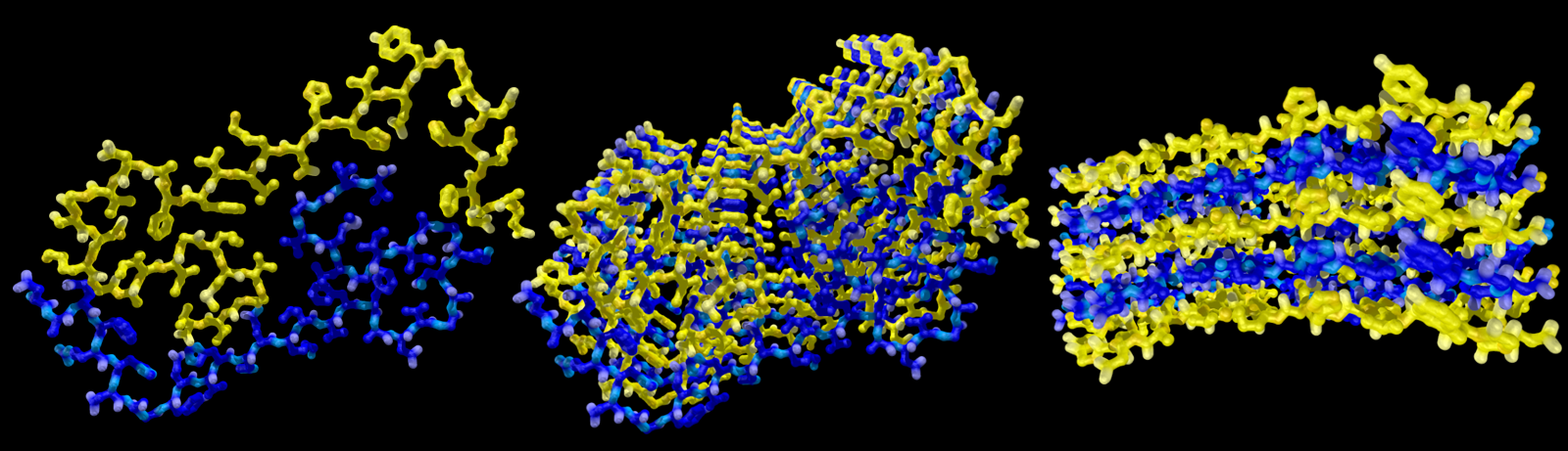 Amyloid-beta plaques