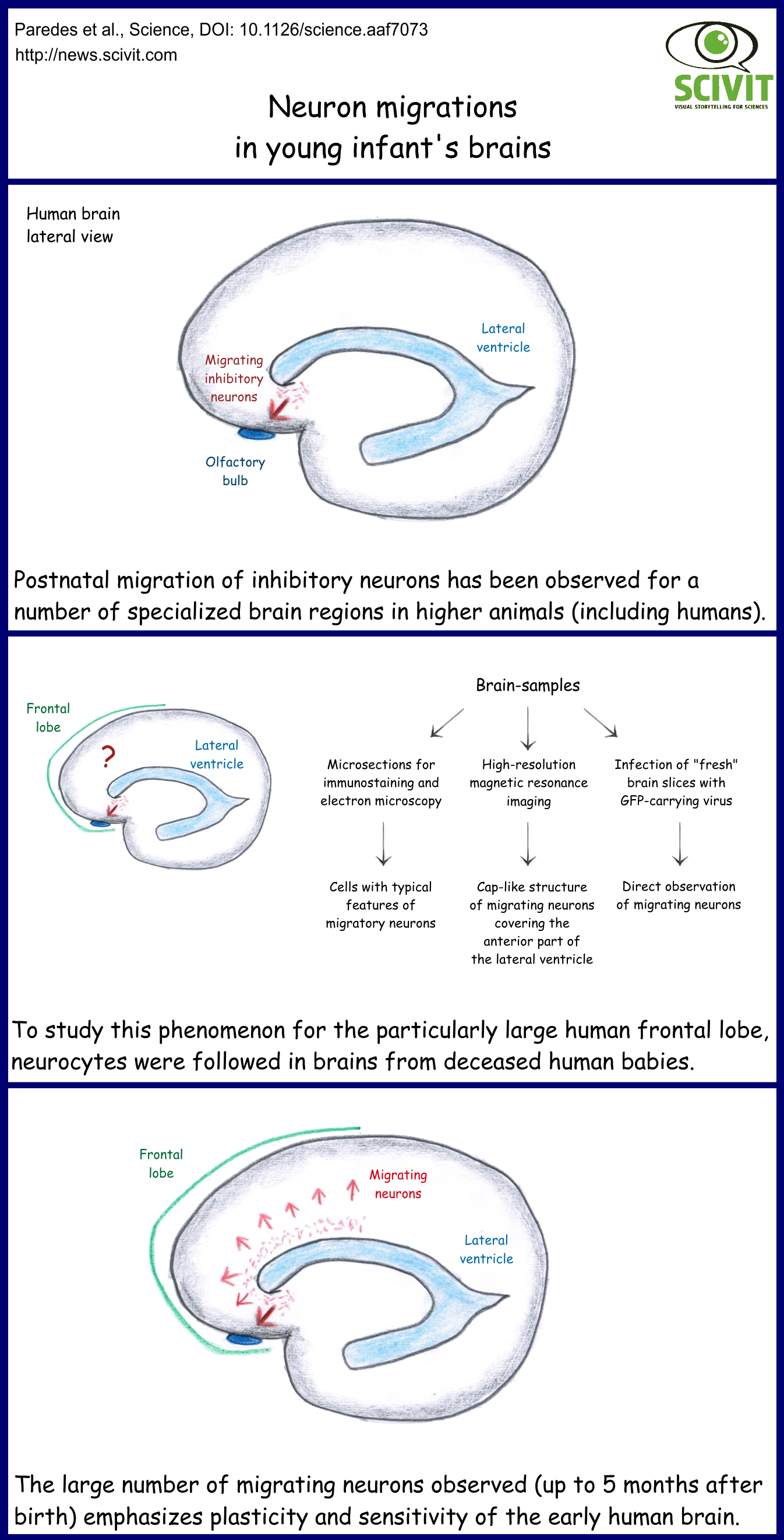  Neuron migrations in young infant's brains