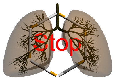 Stop Smoking