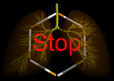 Stop Smoking